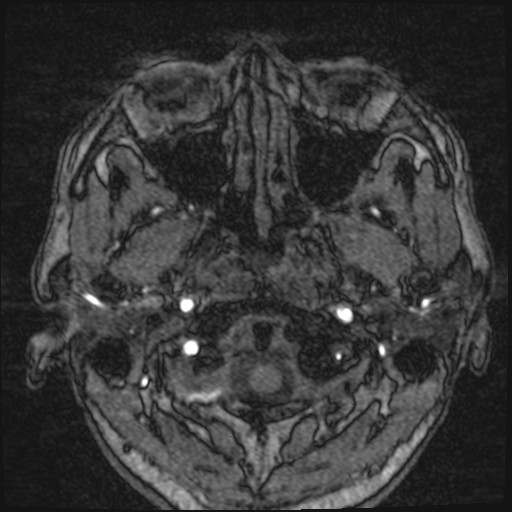 Click on the Serie image to view the images of VILLANUEVA, WILLIAM A.